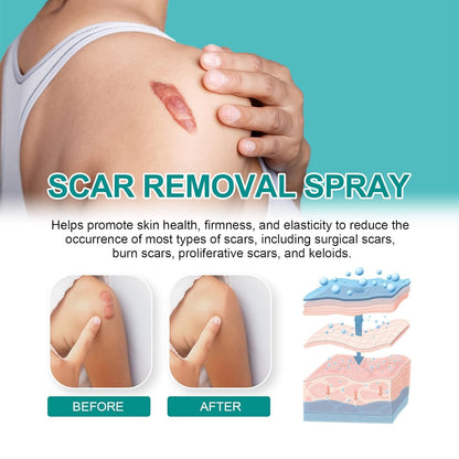 Medical Scar Removal Spray