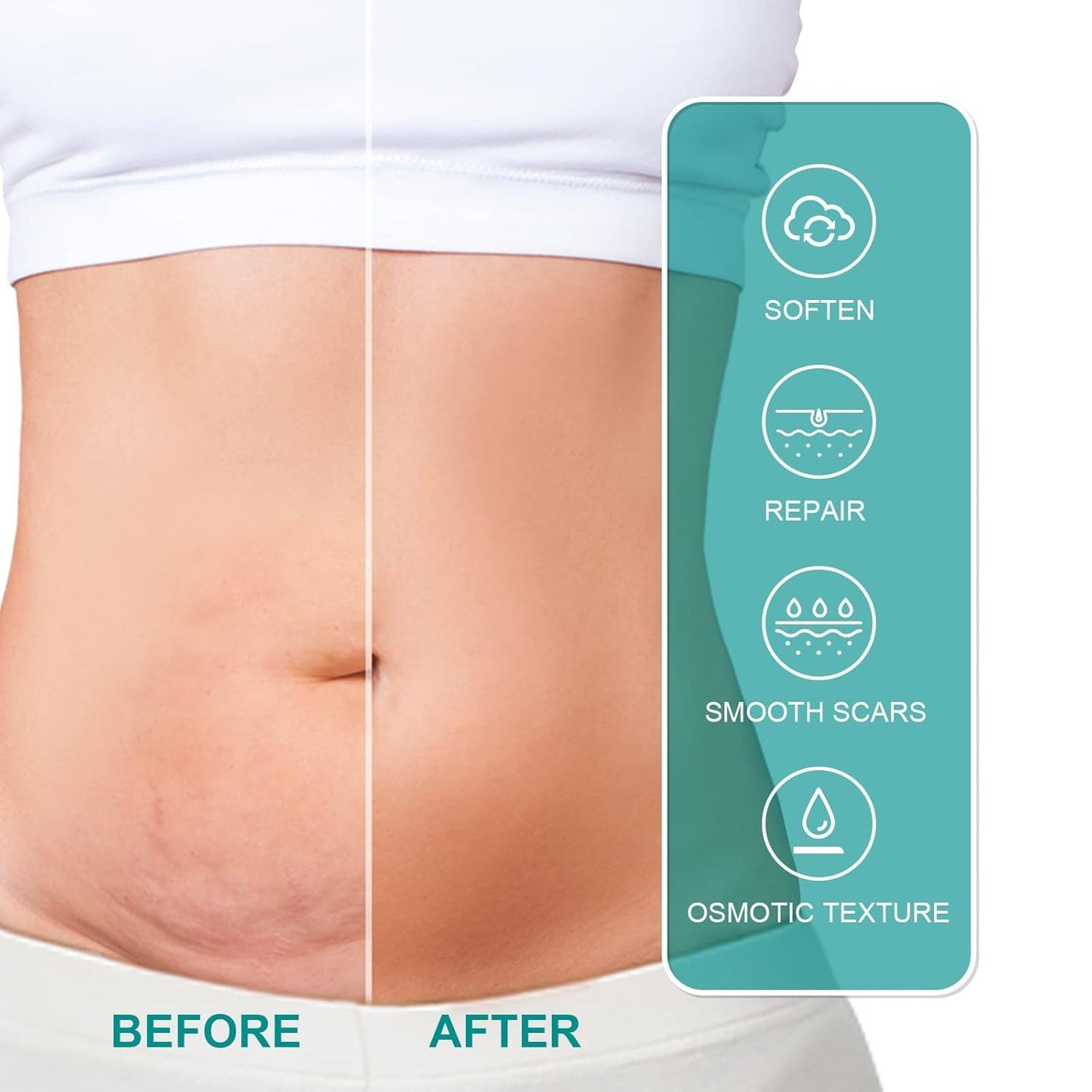 Medical Scar Removal Spray